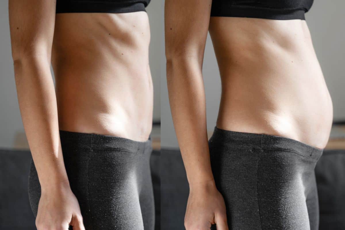 How long does diastasis recti take to improve Kent?
