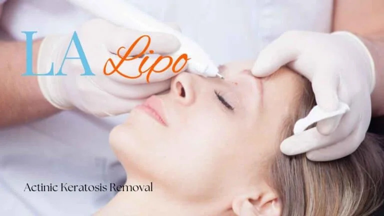 Woman receiving Actinic Keratosis Removal Treatment Kent