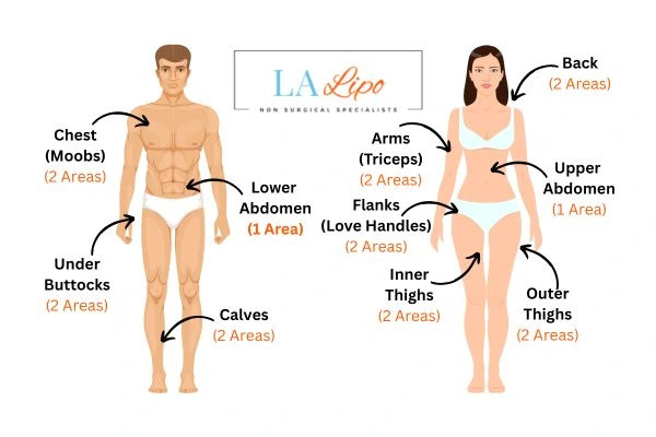 LA LIPO Cryolipolysis Areas Kent
