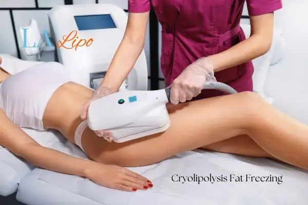 Woman receiving coolsculpting Kent treatment on her thighs