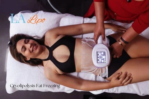 woman getting cryolipolysis Kent