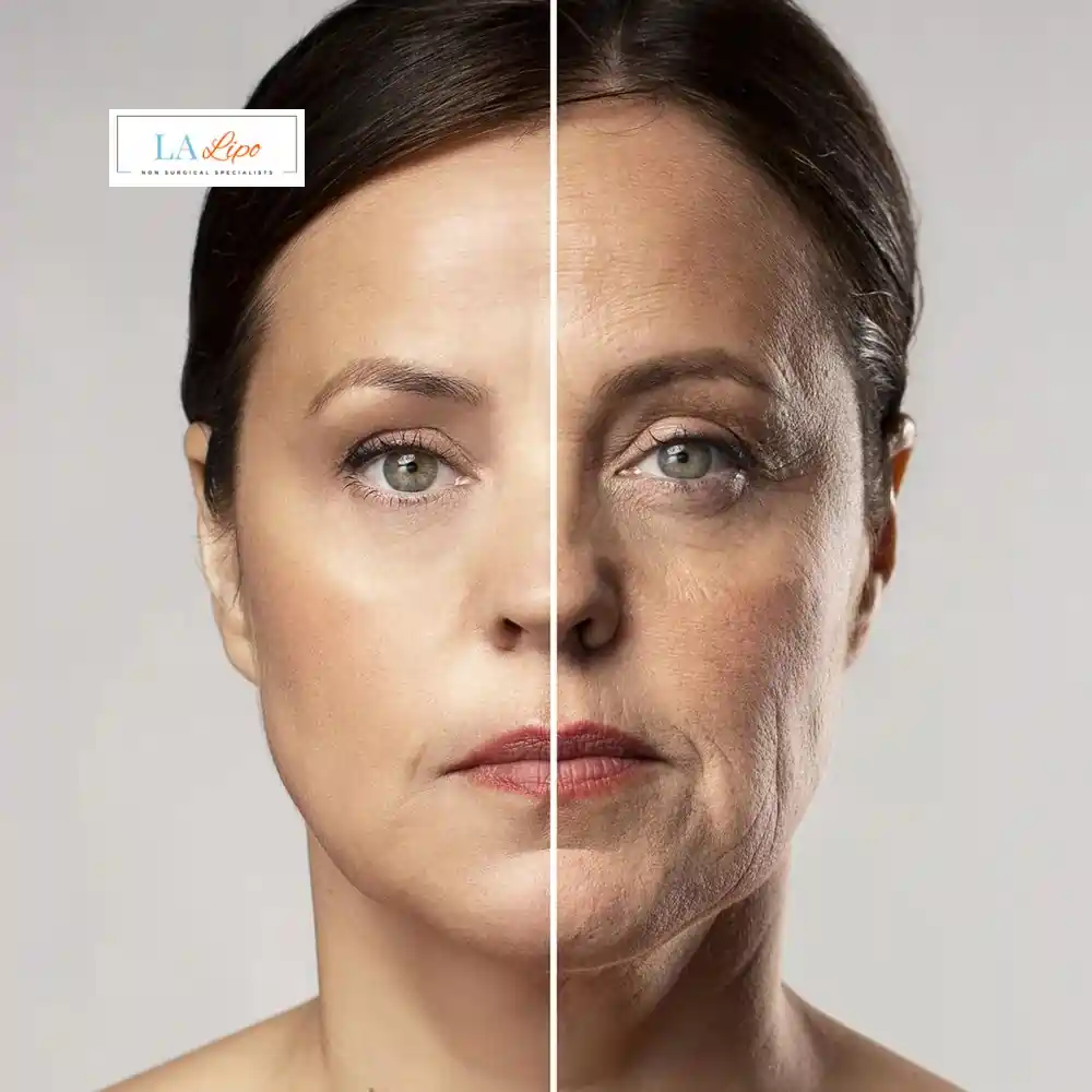 How Can You Tell If Non-Surgical Skin Tightening Is Right for You Kent?