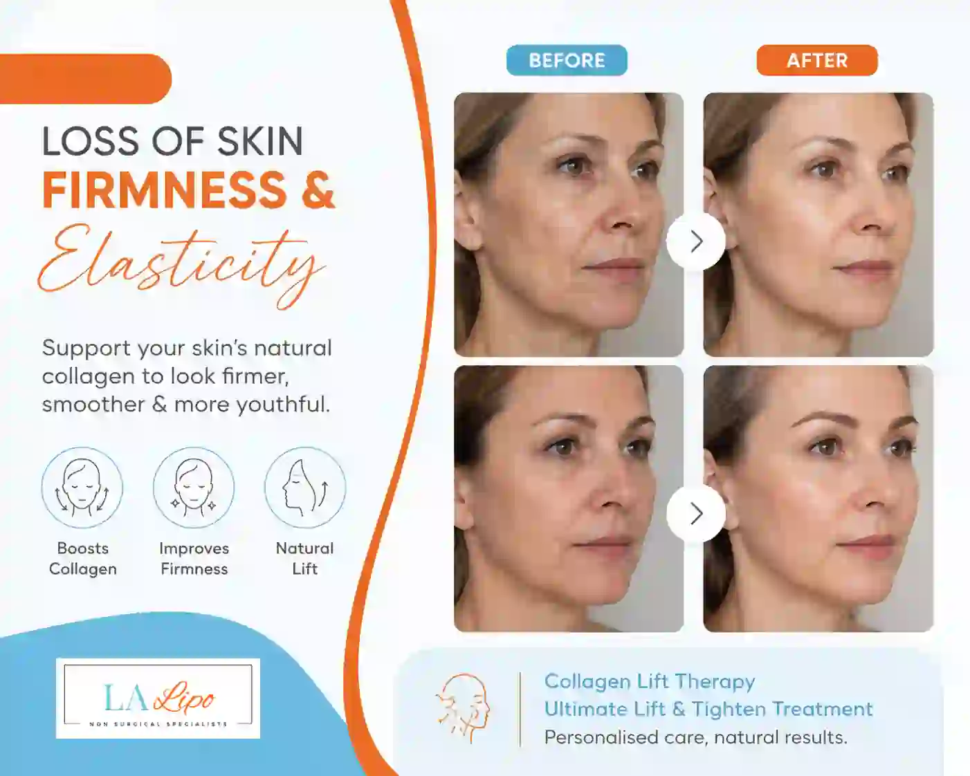 Sign #7: Loss of Skin Firmness and Elasticity Kent