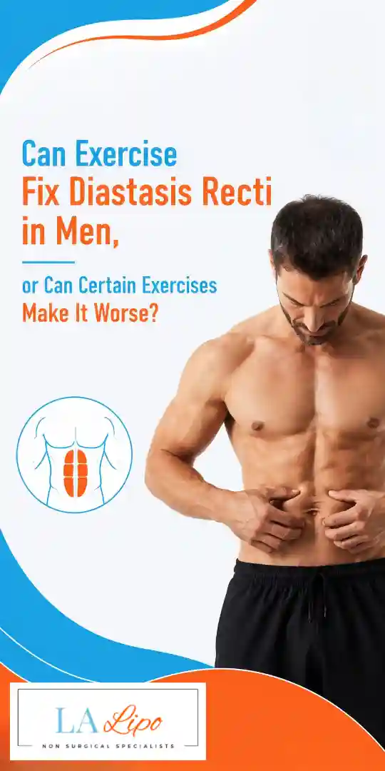 Can Exercise Fix Diastasis Recti in Men, or Can Certain Exercises Make It Worse Kent?